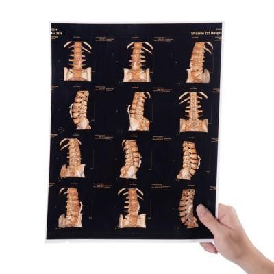 14X17 Inch Ink Jet Blue CT Cr Radiology Medical Xray Film