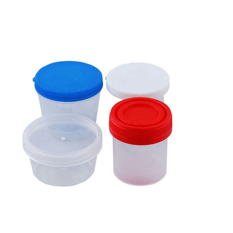 60ml Hospital Urine Sample Containers