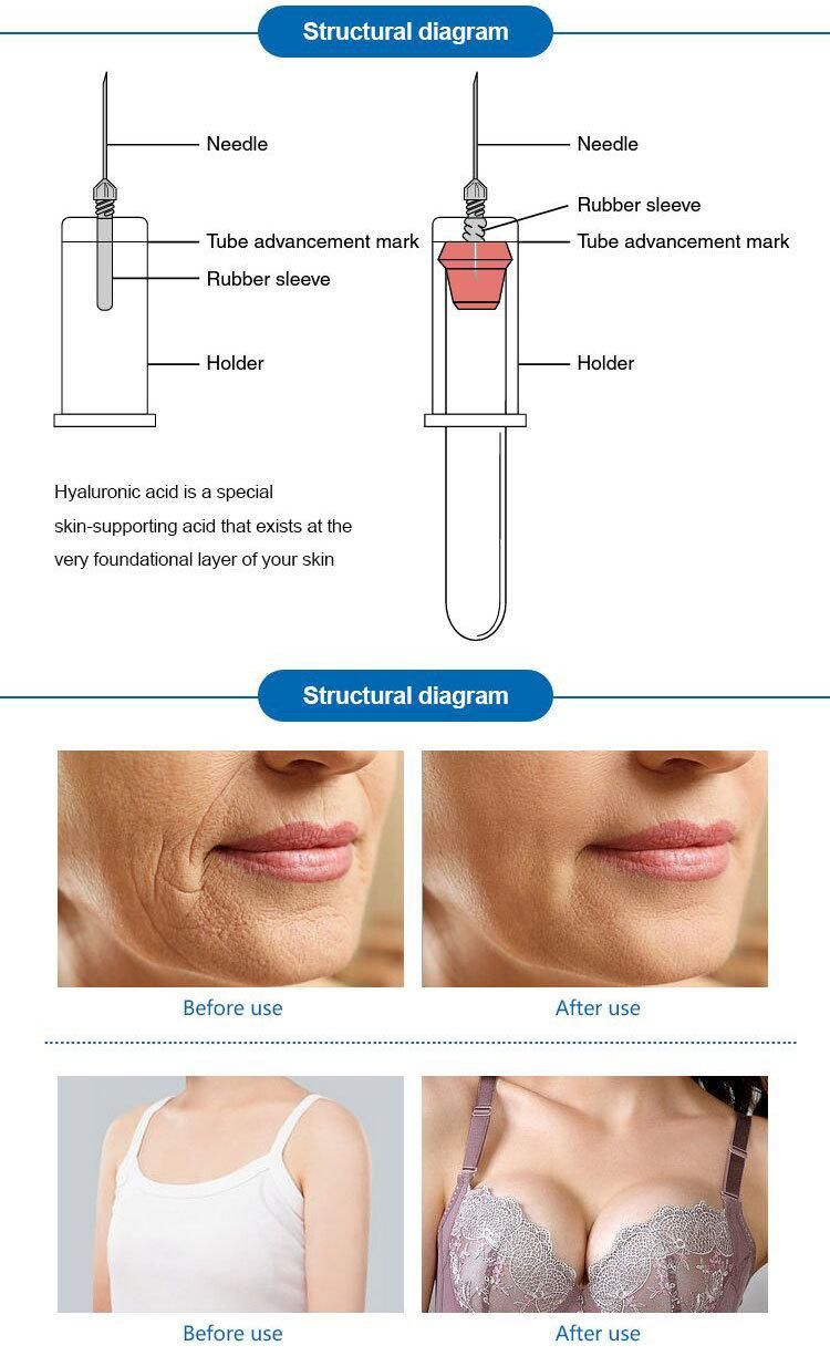 Beauty Personal Care Cross Linked Hyaluronic Acid Injection Dermal Filler Butt/ Buttock Injection