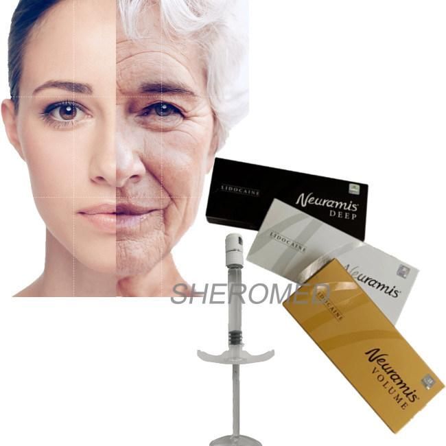 Neuramis Hyaluronic Acid Dermal Filler 1ml Nose Lip Filler