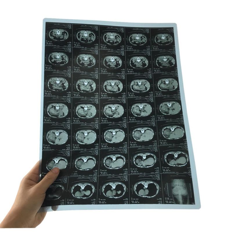 Thermal Blue Medical X-ray Films for Agfa Printer and FUJI Printer