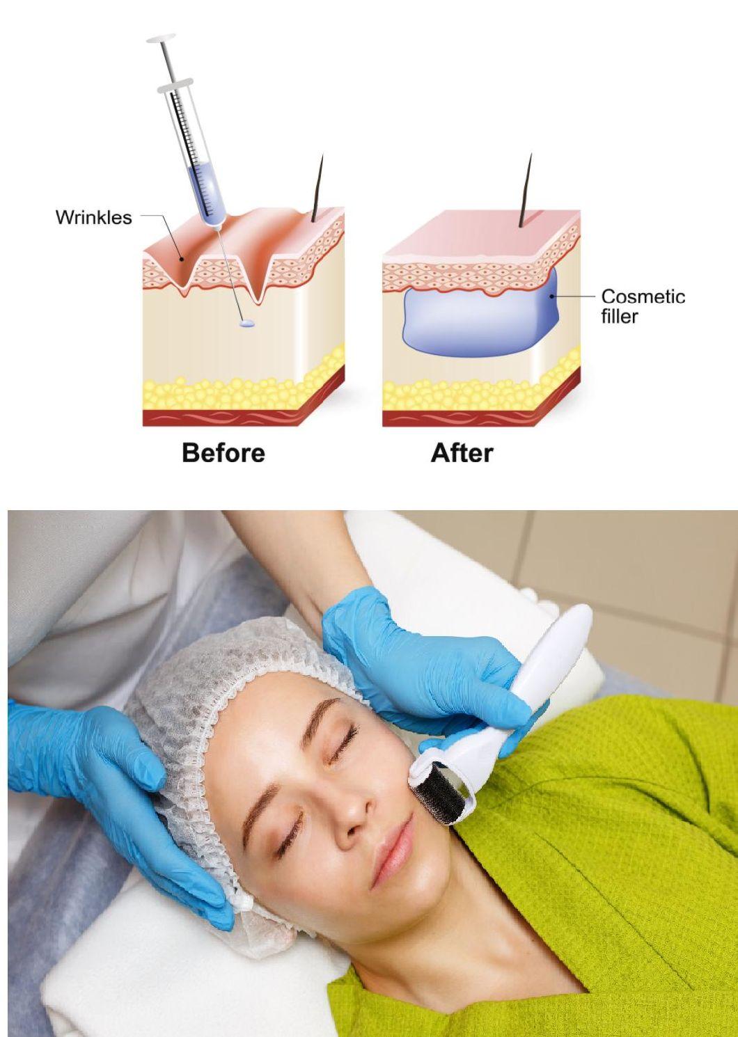 Hyaluronic Acid Injection Stabilized Liquid for Hydrolifting Meso Skin Meso Face Injection
