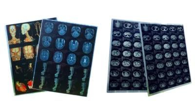 Dry Thermal Medical X Ray Film for FUJI/Kodak/Agfa