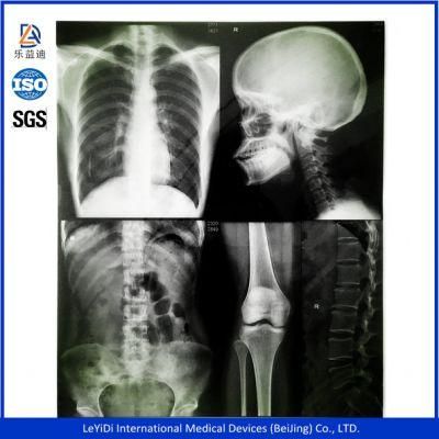 8*10 Inch Medical Dry X-ray Film for FUJI Printers