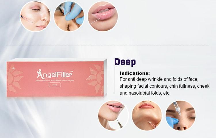 10ml Cosmetic Regenovue Ha Dermal Filler with Lidocaine