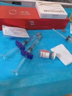 2022 New Product Franch Filorga 5*3ml Nctf 135 Ha Dermal Filler for Skin Repair and Filling