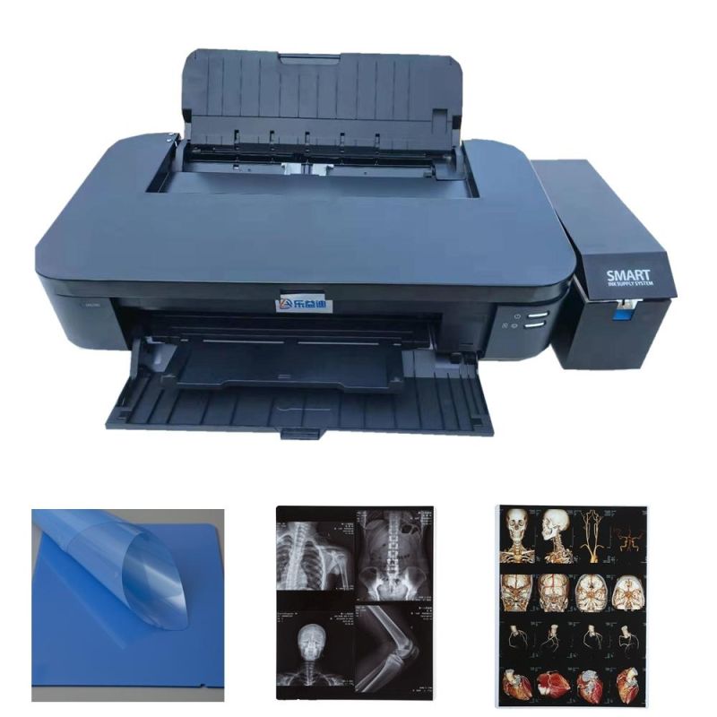 Blue Inkjet Mammogram X-ray Films