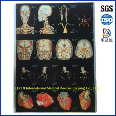 General Medical Image Inkjet Films 35cmx43cm for Radiology