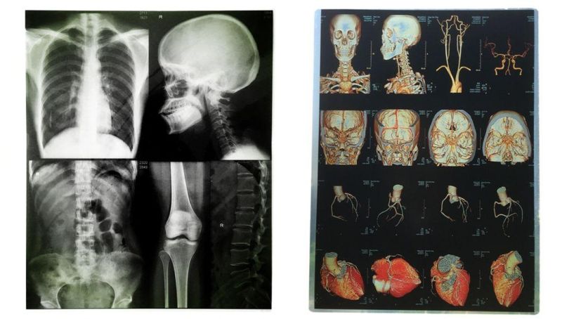 10X12 Inch Pet X-ray Laser Medical Films