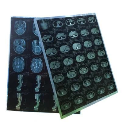 X-ray Film Printer Mammo Inkjet Blue Films