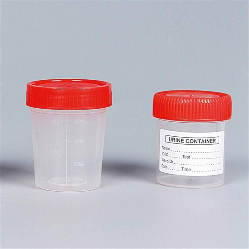 Best Quality Medical PP Urine Cup 30ml 60ml 90ml 120ml Sterile Hospital Urine Container