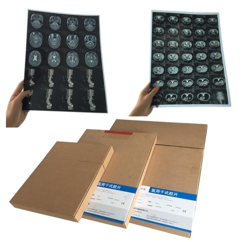 14X17" Laser Imaging Film for Hospital