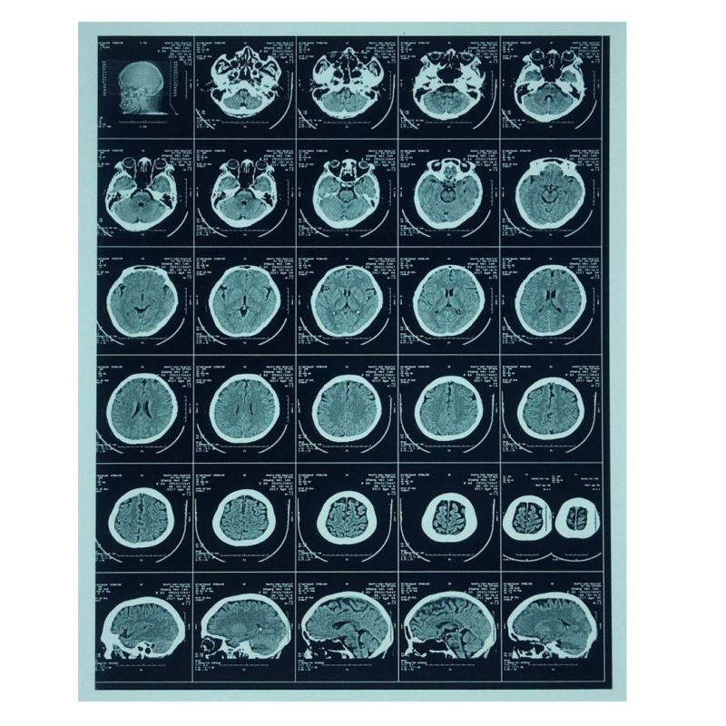 Industrial Radiographic Inkjet Film