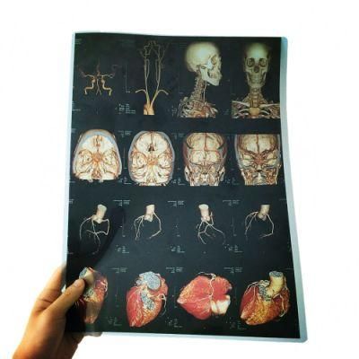 X-ray and Magnetic Resonance Imaging (MRI) Films