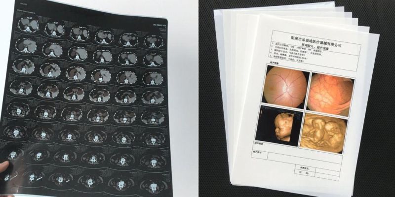 General Medical Image Inkjet Films 35cmx43cm for Radiology