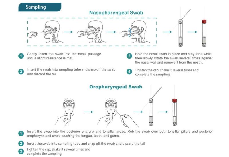 Infectious Virus Igg Igm Test Rapid Antigen Diagnostic Test Strip