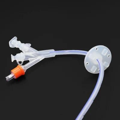 Silicone Gastrostomy Tube/Peg Feeding Tube