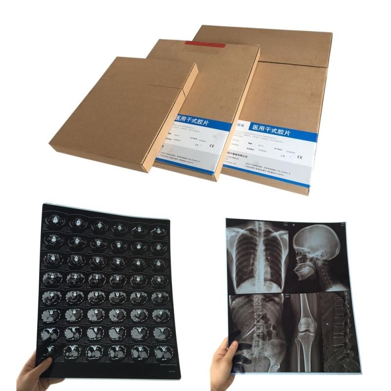 A4 and 10*12" Medical Dry Films for Ultrasound and Radiology