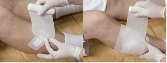 Mdr CE Approved Flexible Rolled Gauze Dressing Conforming Bandage for Minor Wound Care