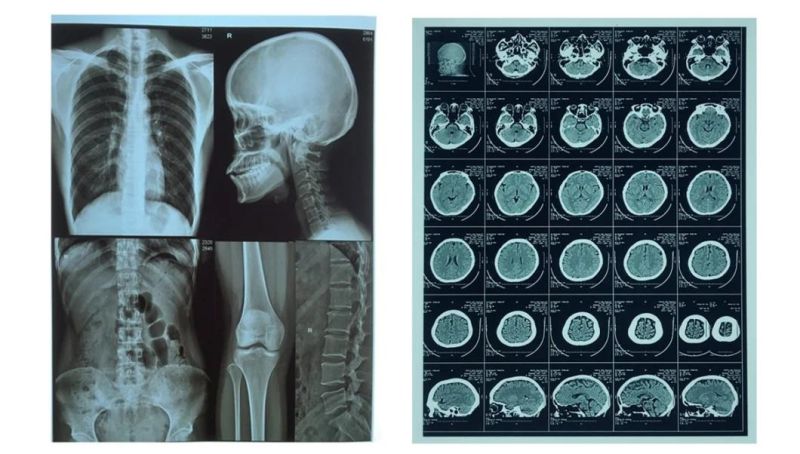 Images of Medical X-ray Film for FUJI Xerox 5005D Printer