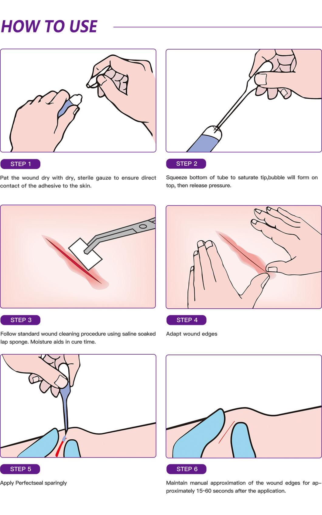 Perfectseal Medical Skin Glue Tissue Adhesive Surgical Glue