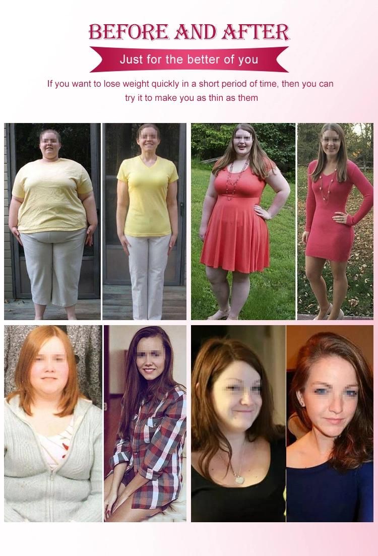 Face Body Fat Dissolving Weight Loss Liquid Body Fat Scale Red Ampoule Solution