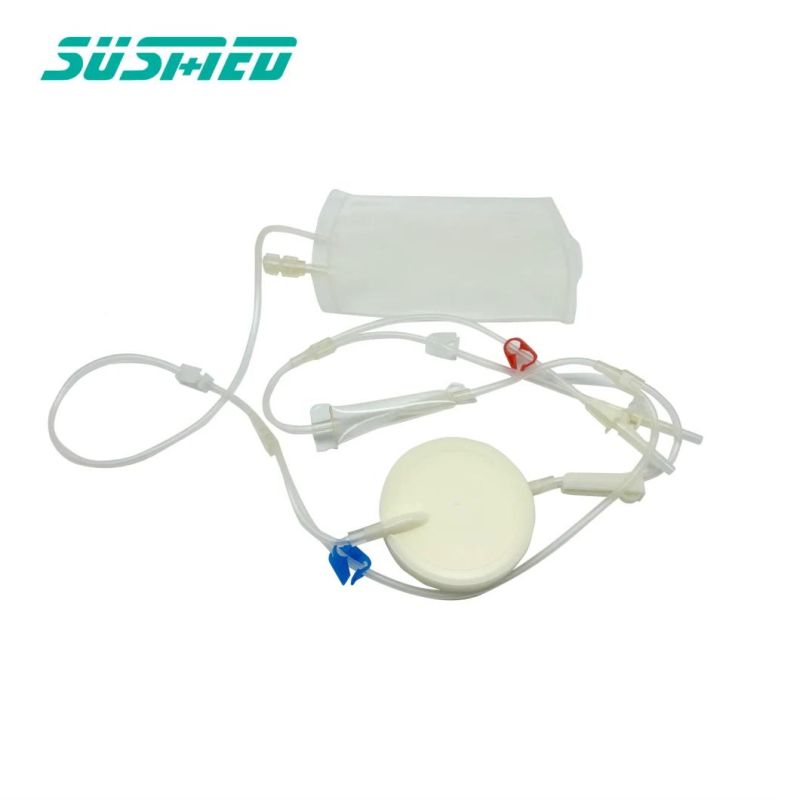 Leukocyte Reduction Filters for Single Use Blood Bank