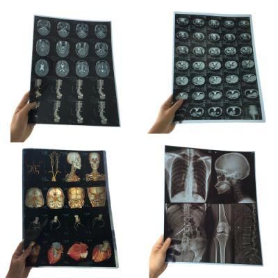 10X12 Inch Pet X-ray Laser Medical Films