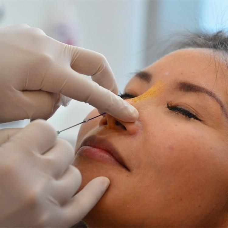 Wrinkle Removal Pdo Mesh Face Lifting Thread with Sharp Needle