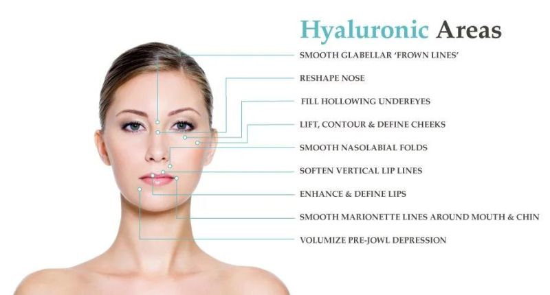 Injectable Sodium Hyaluronate Dermal Filler Cross Linked Hyaluronic Acid for Face Lip Breast Buttocks Penis Enhancement Facial Wrinkle Chin Cheeks Ha Injection