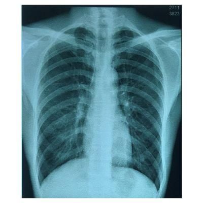 Industrial Radiographic Inkjet Film