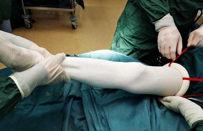 Sterile Disposable Tourniquet Ring Cuff for Exsanguination and Occlusion Used in Limb Surgeries and Emergency Aids Pneumatic Tourniquet Esmarch Bandage
