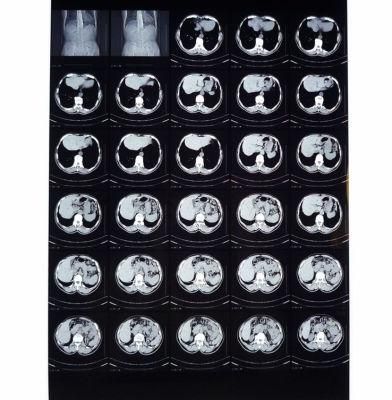 Cheap 14X17in Blue Medical Iamging Film with FUJI/Agfa/Canon Printer
