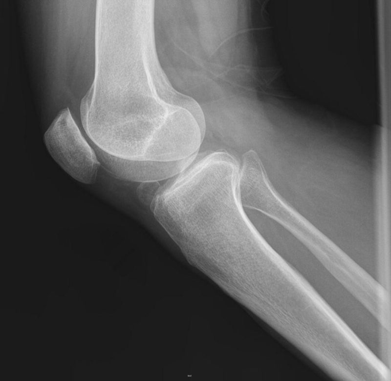 Pet Medical X-ray Laser Printing Film/Image