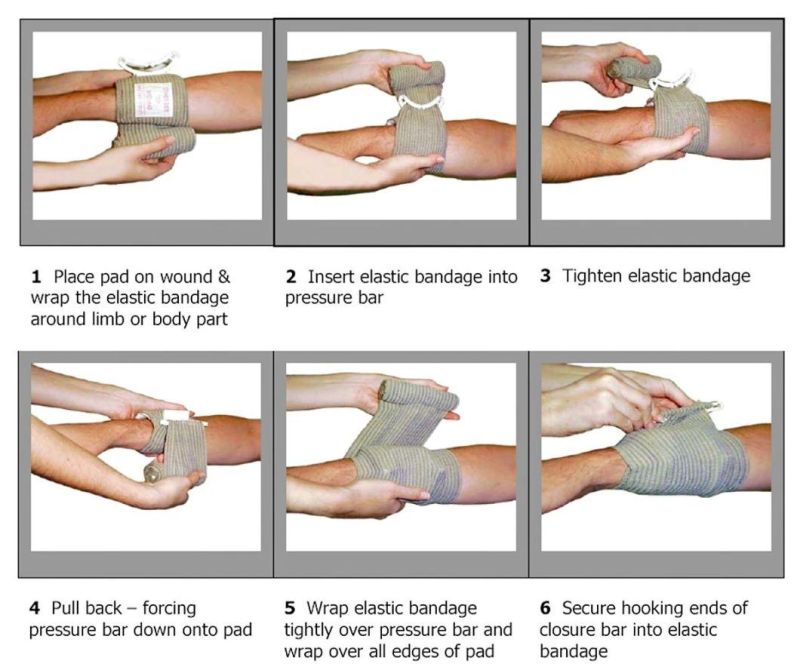 Mdr CE Approved Eo Sterilization Medical Elastic Cotton Emergency Bandage