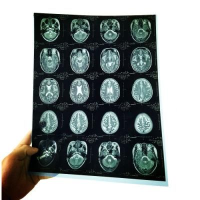 Medical X-ray Dry Laser Image Printer X-ray Films
