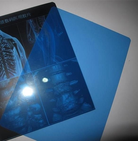 X-ray Medical Dry Film