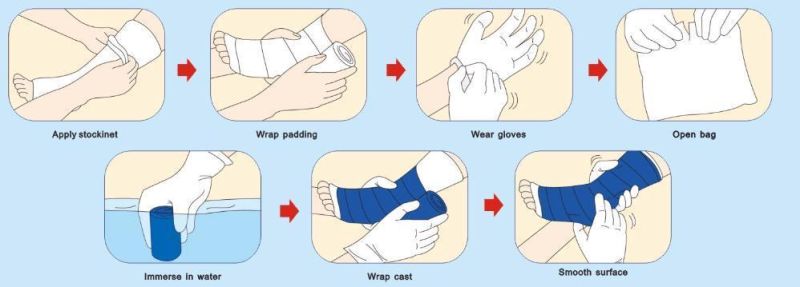 Clear X-ray Waterproof Fiber Glass Cast Bandage with Polyurethane