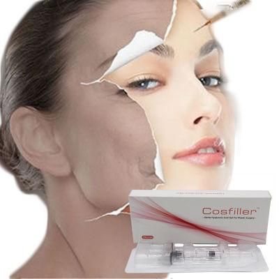 CE Hyaluronic Acid Ha Dermal Filler Korea Dermal Filler for Face