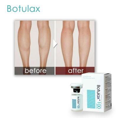 Toxina Botulinica Botulax Toxin a Injection Acid