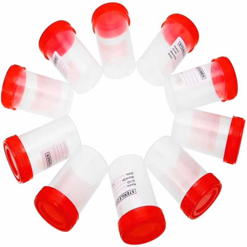 10ml/30ml/60ml/90ml/120ml Medical Sterile Specimen Urine Cup Collection Container
