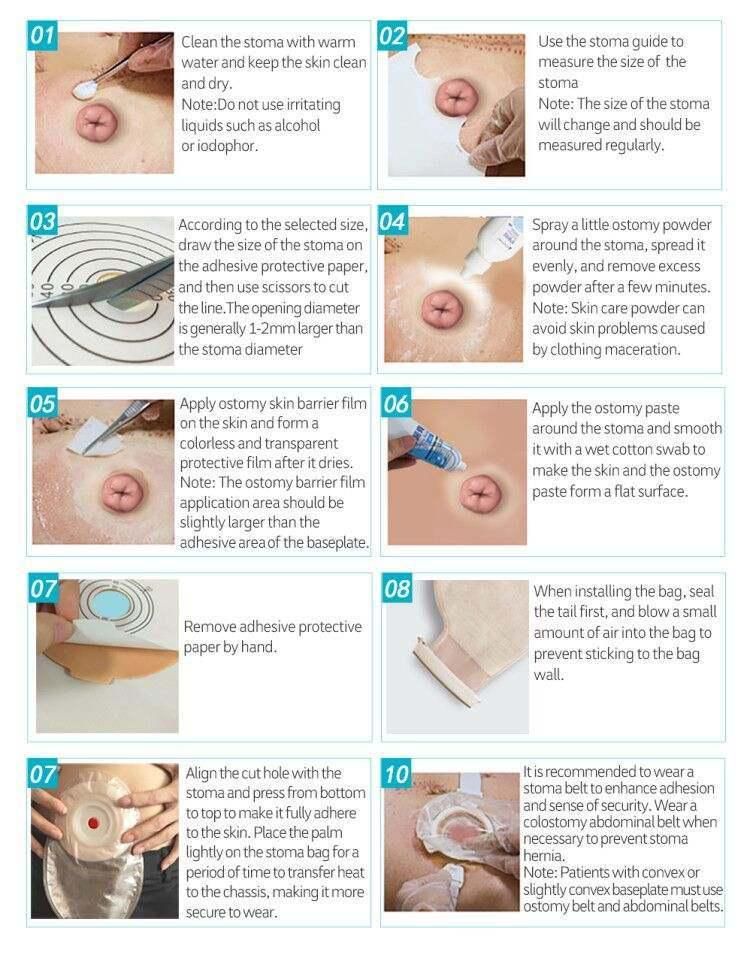 1/6one Piece Open Ostomy Pouch Colostomy Bag Ileostomy Bag
