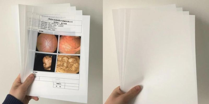 Images of Medical X-ray Film for FUJI Xerox 5005D Printer