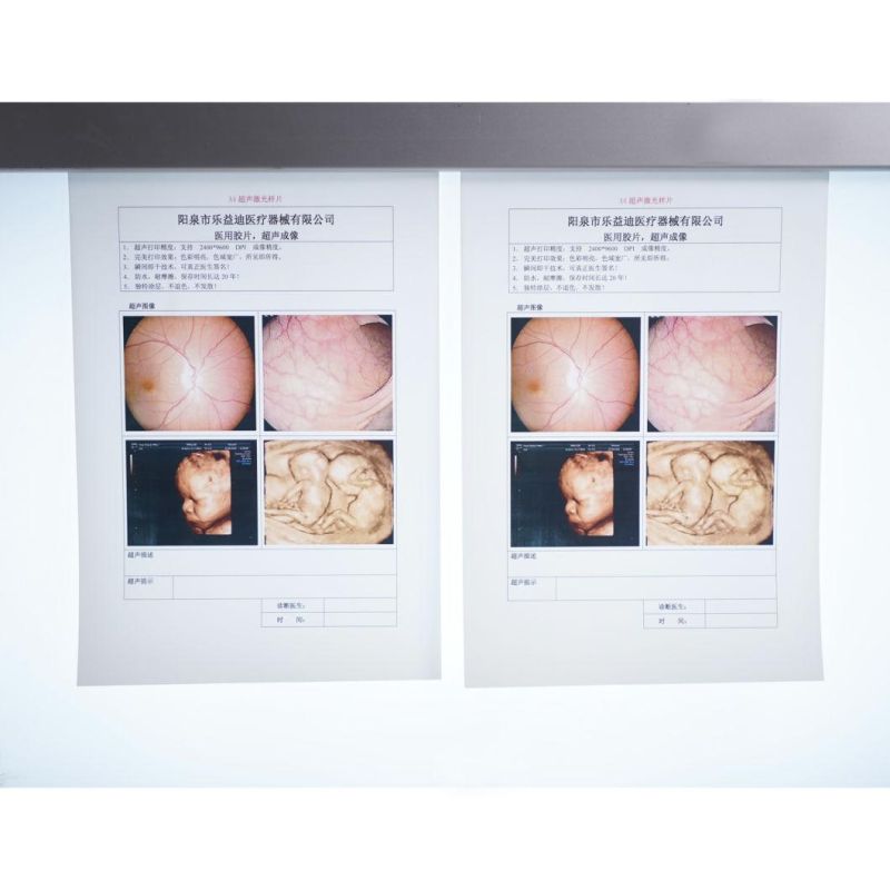 Hospital Usage A4 White Medical Dry Ultrasound X-ray Film / Pet Film