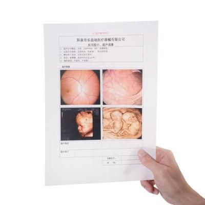 White Pet Ultrasound Medical Film for Inkjet Printing
