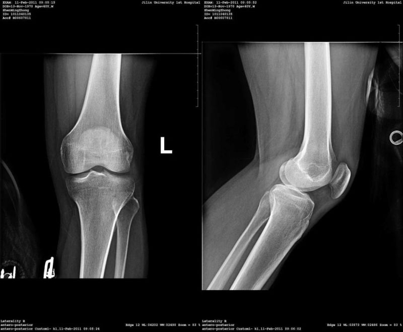 Medical Dry Film