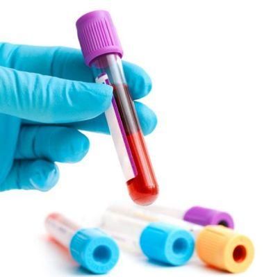 EDTA Tube for Blood Collection