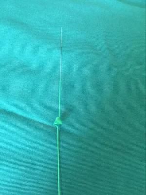 Anti-Retropulsion Calculi Stone Blocking Coil with CE Certificate