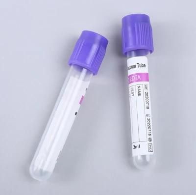 Collection Sampling Blood Tube Blood Draw Tubes Vacuum Blood Collection Tube