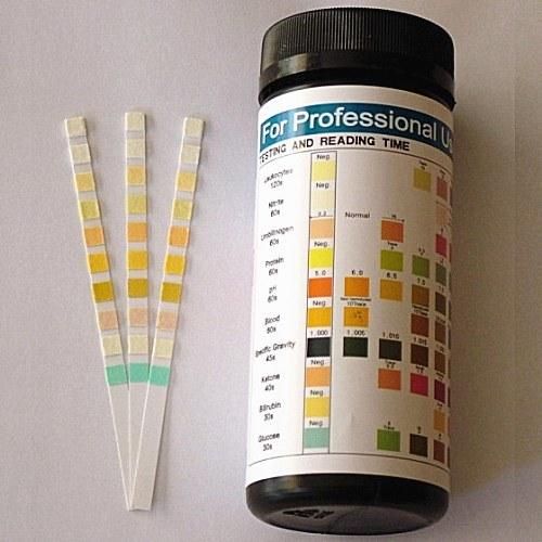 Urinalysis Test Strips/Urine Dipstick Test
